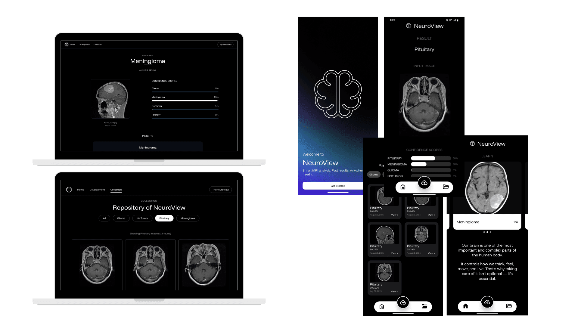NeuroView project