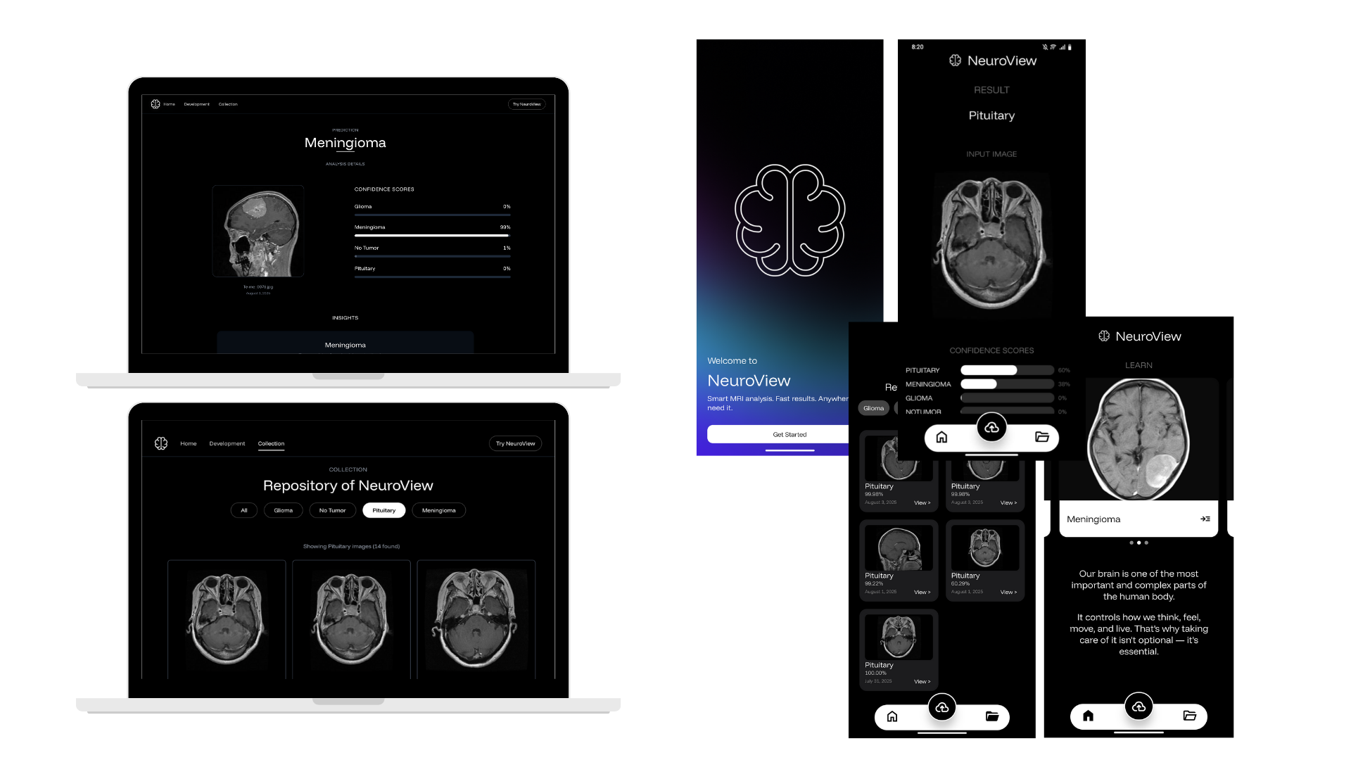 NeuroView project preview